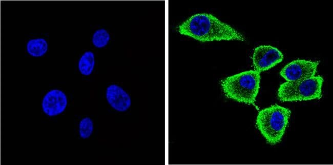 alpha Synuclein Monoclonal Antibody (Syn 211)