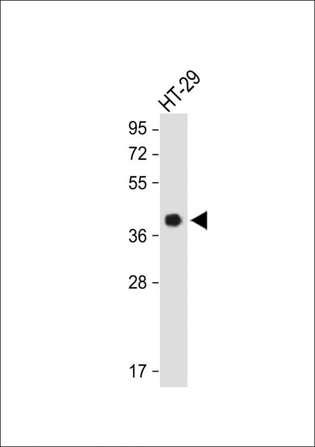 OR2AT4 Polyclonal Antibody