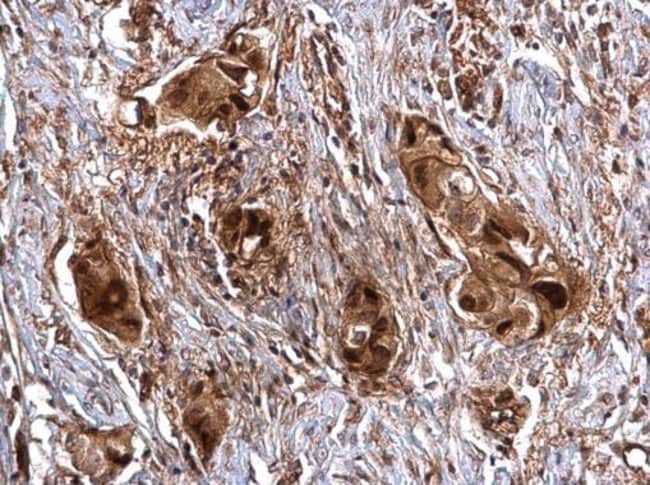 SNAIL Polyclonal Antibody