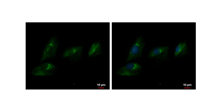 ENPP2 Polyclonal Antibody