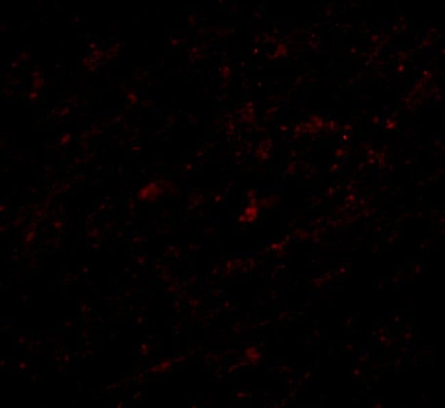 Lass5 Polyclonal Antibody