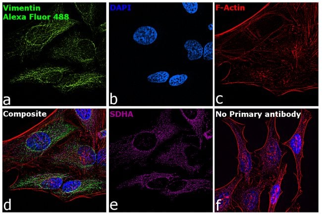 Donkey anti-Chicken IgY (H+L) Highly Cross Adsorbed Secondary Antibody, Alexa Fluor 488