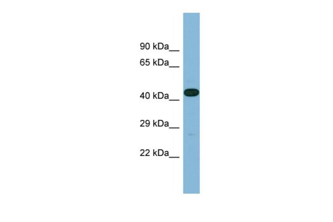 LRRC49 Polyclonal Antibody
