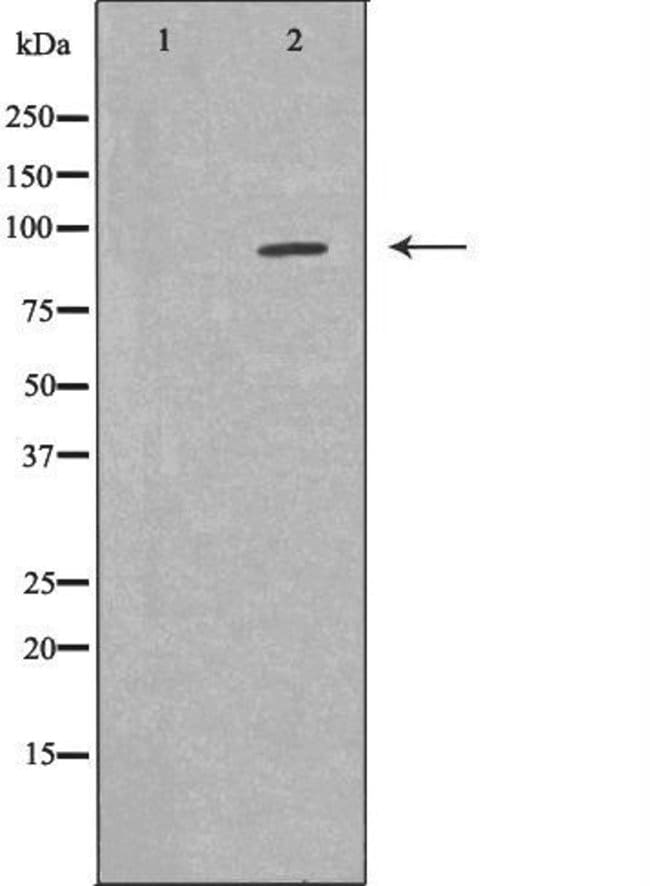 FES Polyclonal Antibody