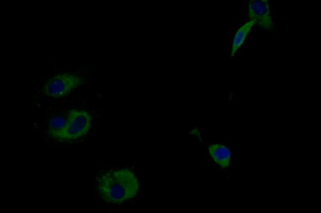 IFNLR1 Polyclonal Antibody