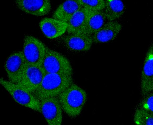 ACE2 Recombinant Rabbit Monoclonal Antibody (SN0754)