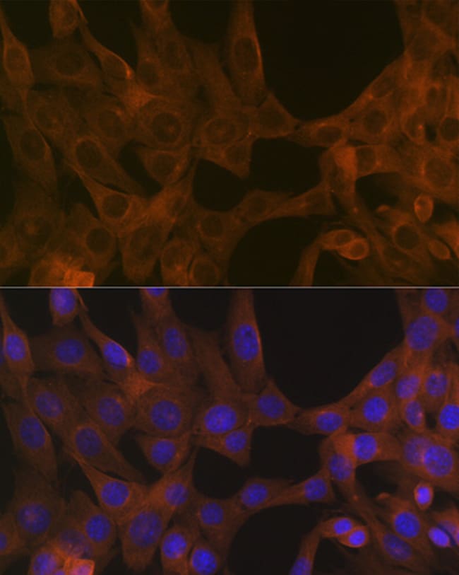 ACVR1B Recombinant Rabbit Monoclonal Antibody (3U6I8)