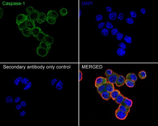 Caspase 1 Recombinant Rabbit Monoclonal Antibody (SU40-07)