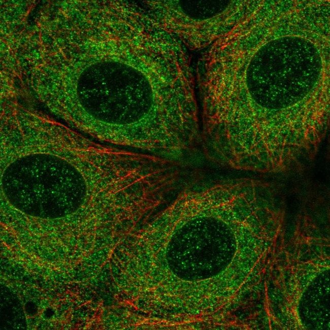 SLC27A3 Polyclonal Antibody