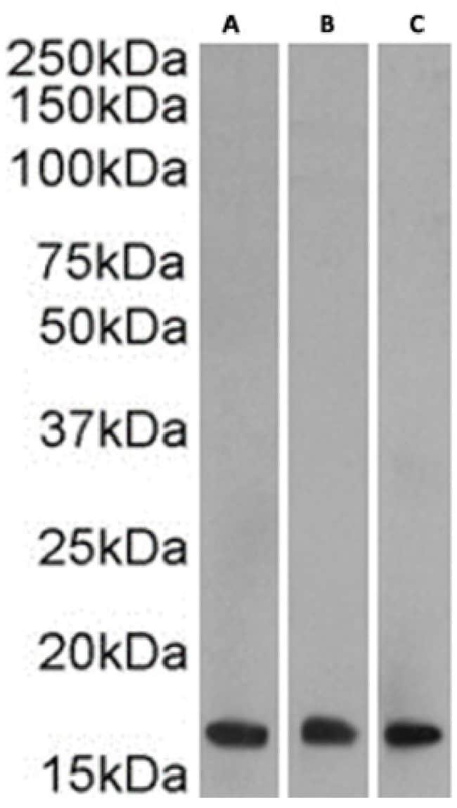 H3K27me3 Chimeric Recombinant Rabbit Monoclonal Antibody (BT164)
