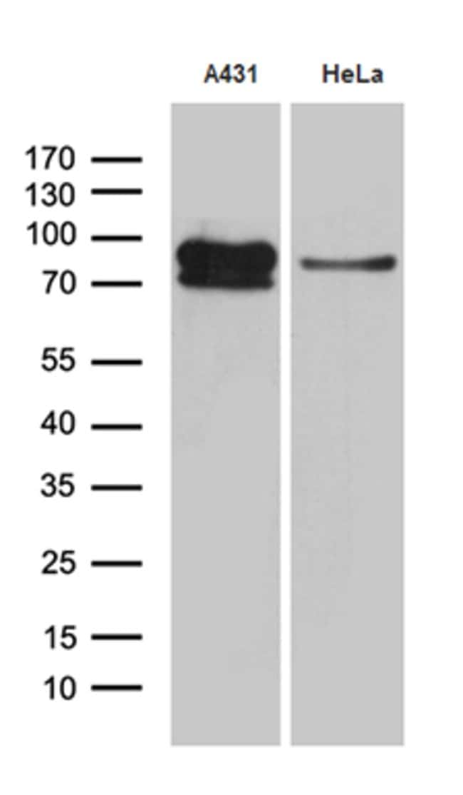 EEF1D Monoclonal Antibody (OTI6B3)