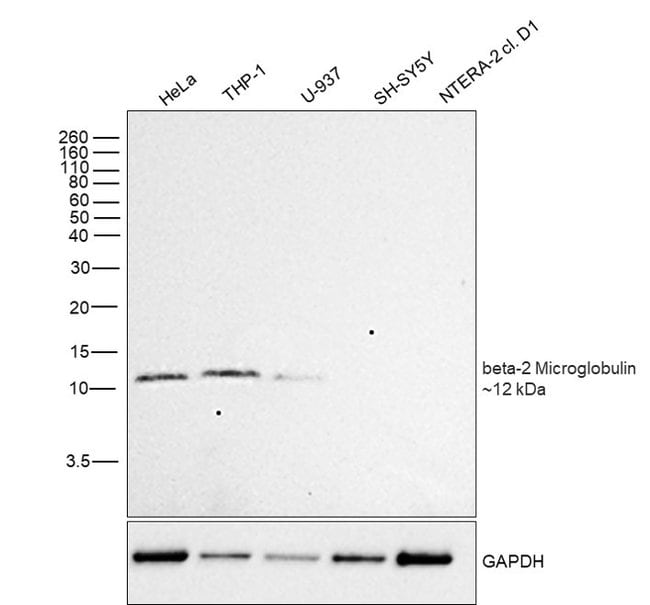 beta-2 Microglobulin Monoclonal Antibody (B2M-01)
