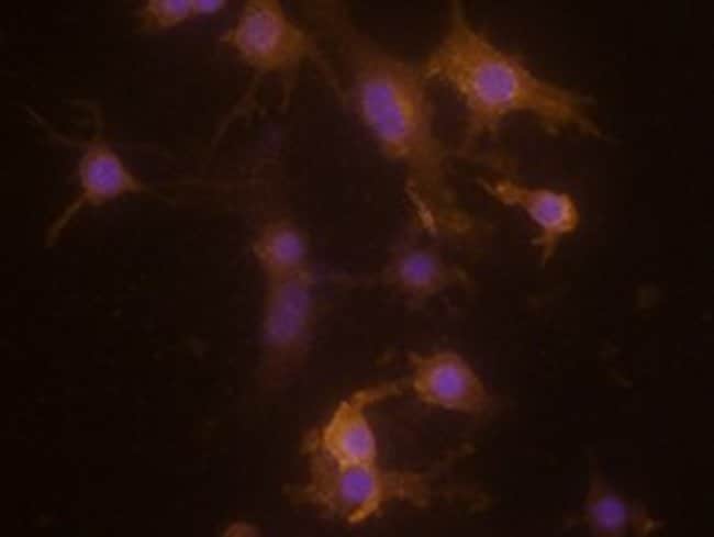 CLEC5A Polyclonal Antibody