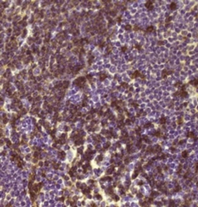 CD45R (B220) Monoclonal Antibody (RA3-6B2), eBioscience