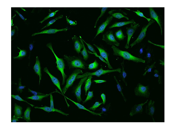MTRR Polyclonal Antibody