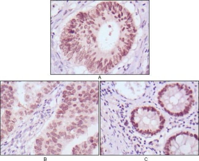 FOXA2 Monoclonal Antibody (7H4B7)