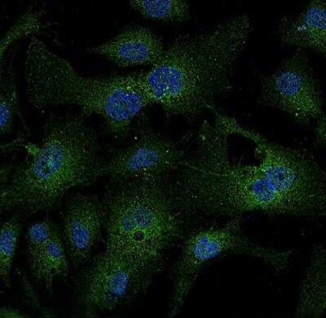 LDLR Polyclonal Antibody