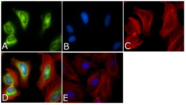 PLK1 Antibody Cocktail