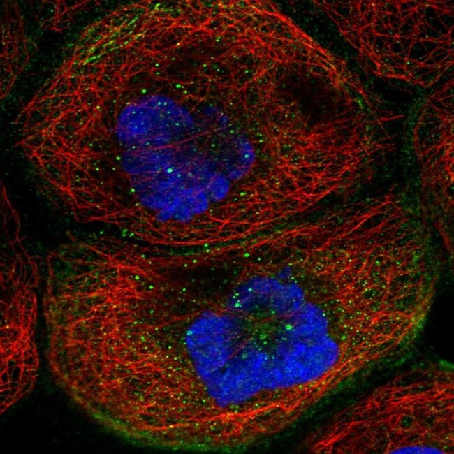TMEM63B Polyclonal Antibody
