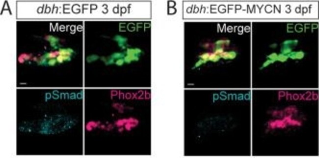 Goat anti-Mouse IgG1 Cross-Adsorbed Secondary Antibody, Alexa Fluor 594