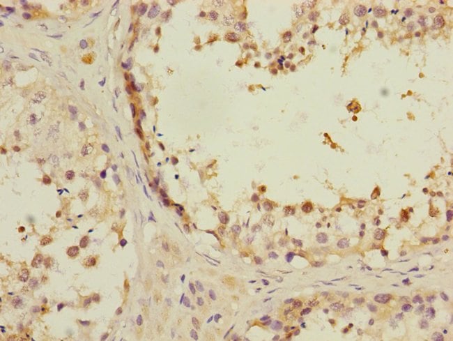 ANKS1B Polyclonal Antibody