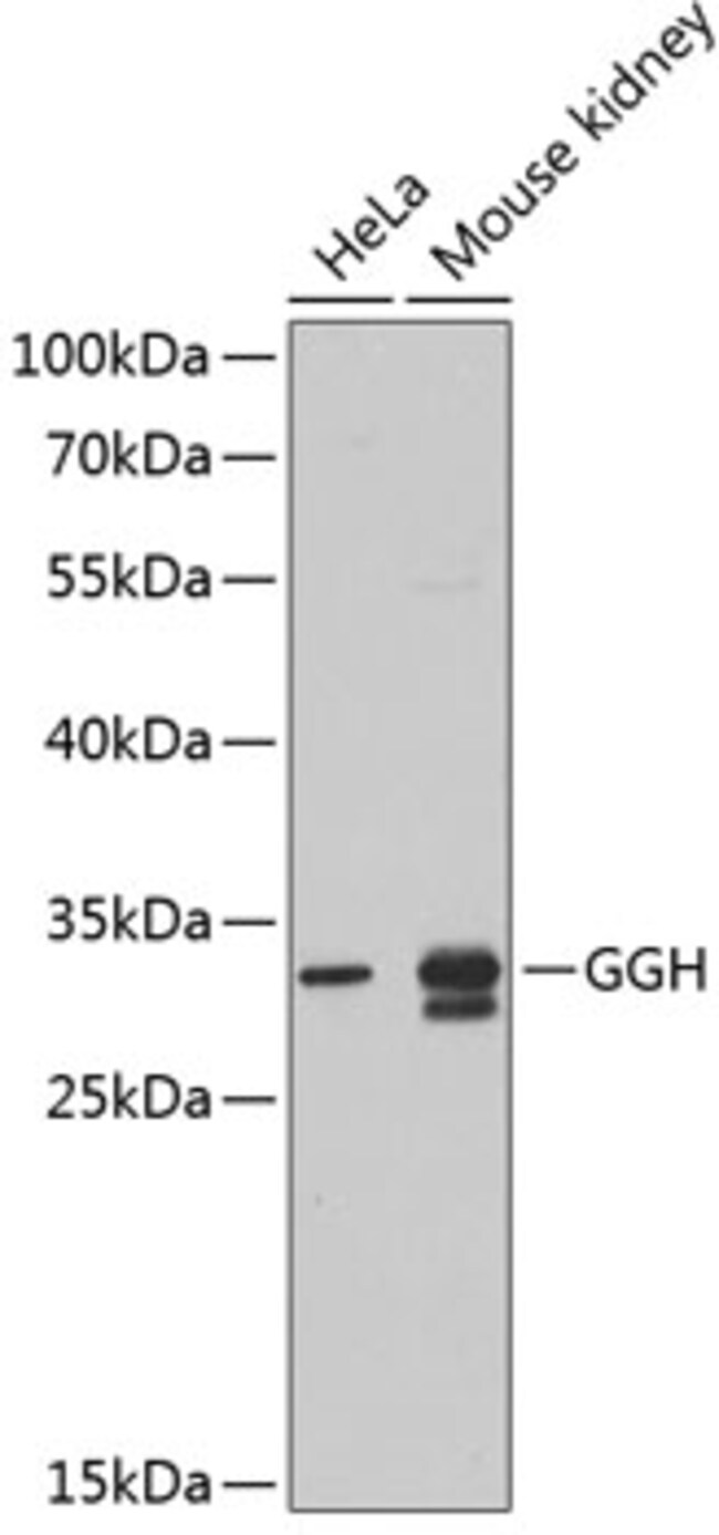GGH Polyclonal Antibody
