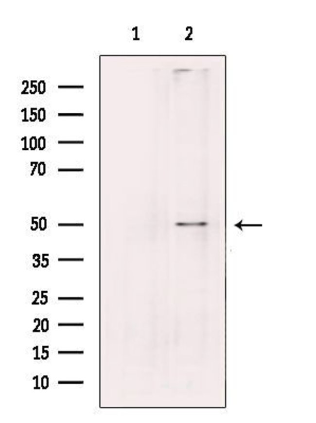 PLD4 Polyclonal Antibody