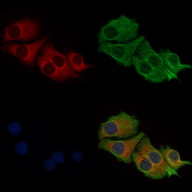 MYL6 Polyclonal Antibody