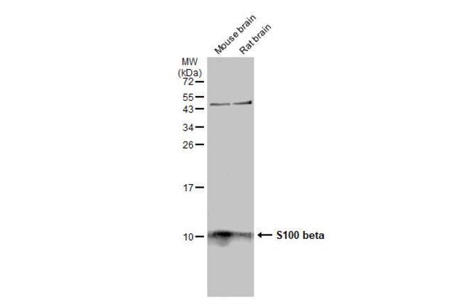 S100B Polyclonal Antibody