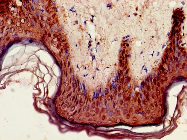 GPIHBP1 Polyclonal Antibody