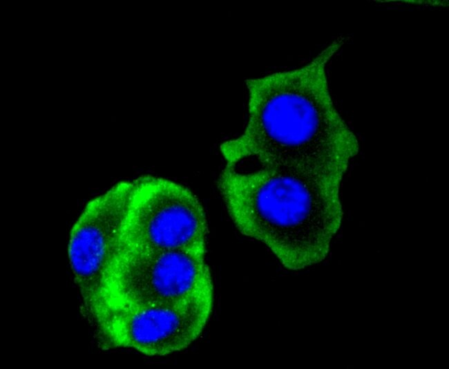 Cytokeratin 14 Recombinant Rabbit Monoclonal Antibody (SC65-06)