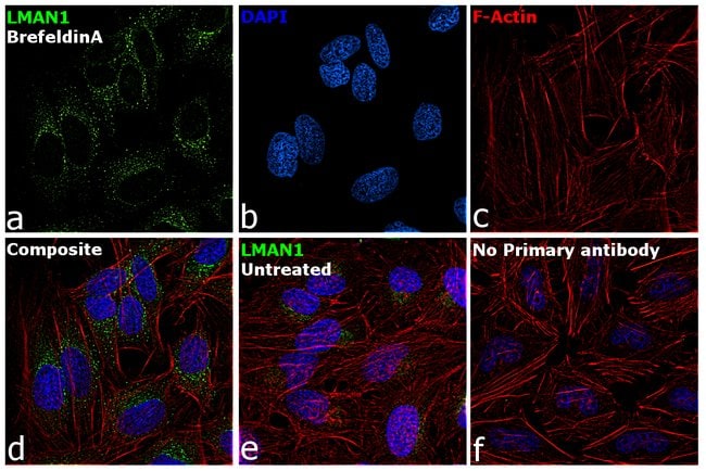 LMAN1 Monoclonal Antibody (OTI1C5)