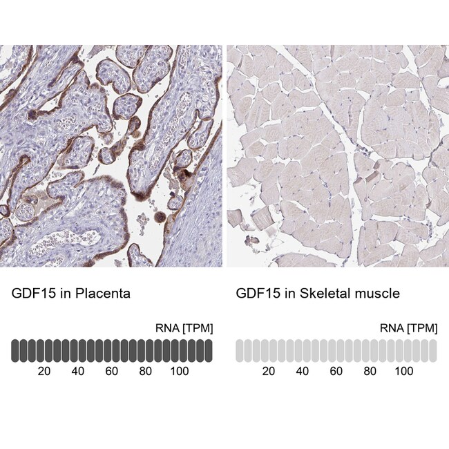GDF15 Monoclonal Antibody (CL0328)