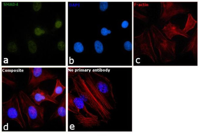 SMAD4 Polyclonal Antibody