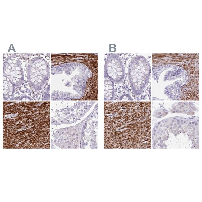 SYNM Polyclonal Antibody