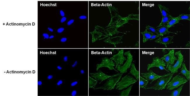 beta Actin Monoclonal Antibody (15G5A11/E2)
