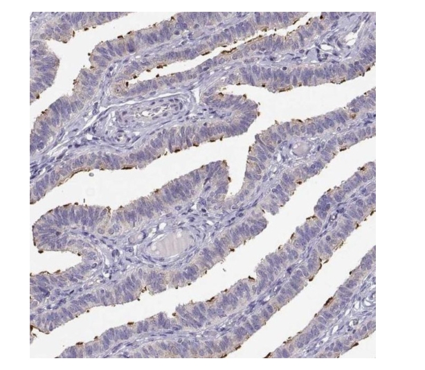 KIF19 Polyclonal Antibody