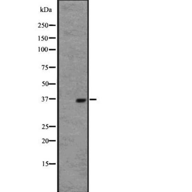OR2W1 Polyclonal Antibody
