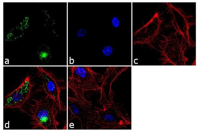 VWF Monoclonal Antibody (F8/86)