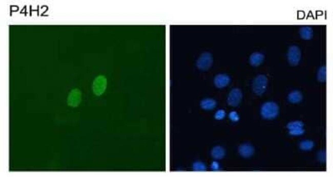 DUX4 Monoclonal Antibody (P4H2)