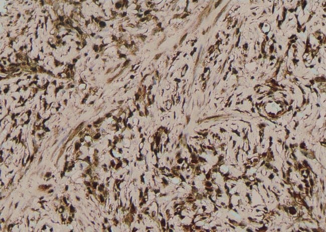 Phospho-MLKL (Ser358) Polyclonal Antibody