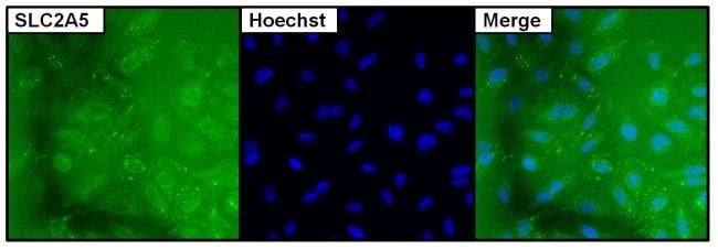 SLC2A5 Monoclonal Antibody (14C8)
