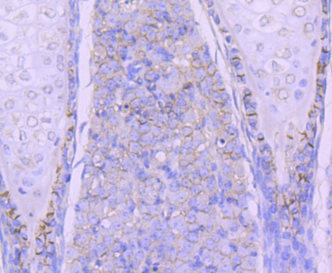 N-cadherin Recombinant Rabbit Monoclonal Antibody (SY02-46)