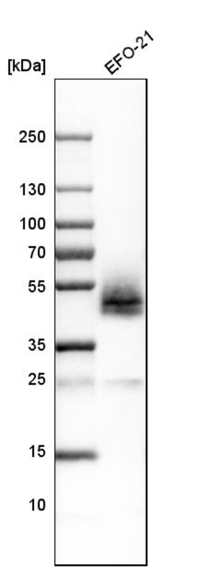 Podoplanin Polyclonal Antibody