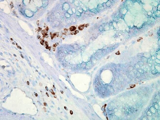 HSP70 Monoclonal Antibody (C92F3A-5), APC