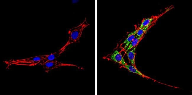 SREBP2 Polyclonal Antibody
