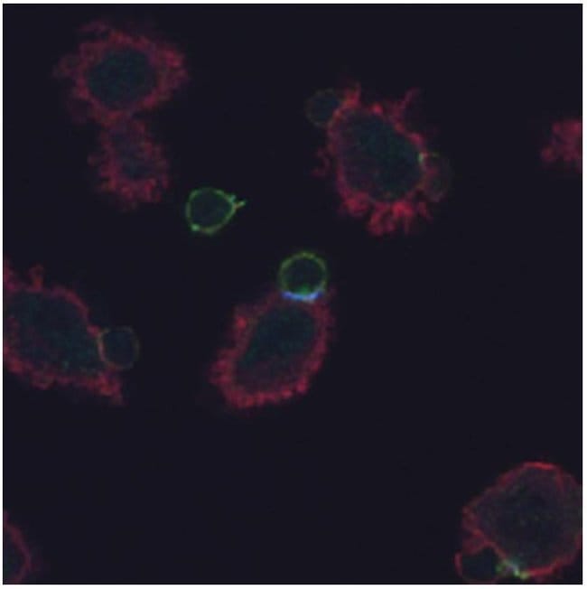 Phospho-CD247 (CD3 zeta) (Tyr72) Monoclonal Antibody (EM-26)