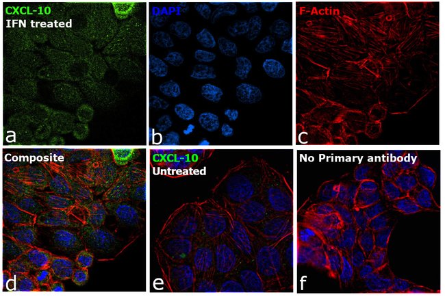 CXCL10 (IP-10) Recombinant Rabbit Monoclonal Antibody (JA10-82)