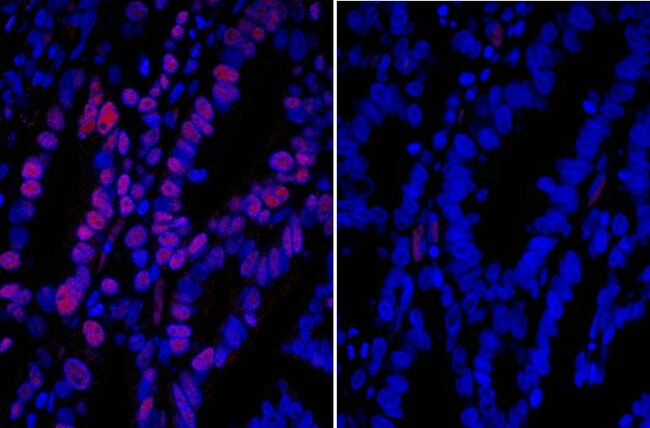 Donkey anti-Goat IgG (H+L) Cross-Adsorbed Secondary Antibody, DyLight 594