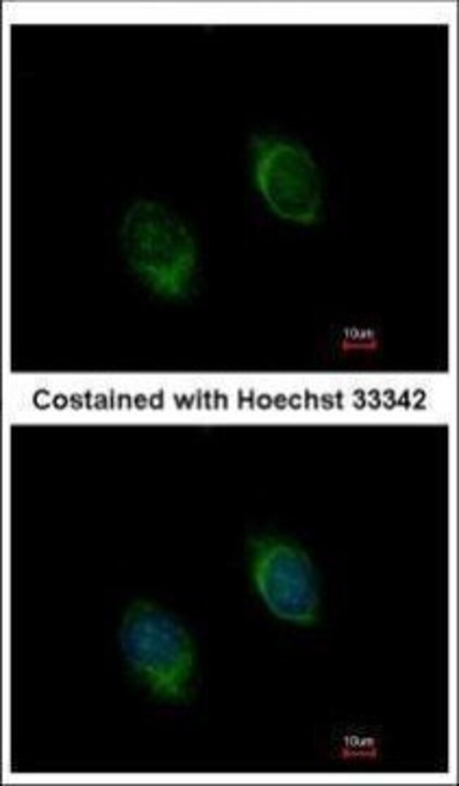 BMP-4 Polyclonal Antibody